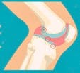 arthrose_blog_3