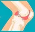 arthrose_blog_4