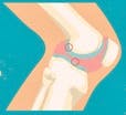 arthrose_blog_2