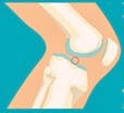 arthrose_blog_1